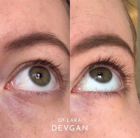 Dr. Lara Devgan Platinum Long Lash Review: A Dermatologist-Backed Approach to Fuller Lashes